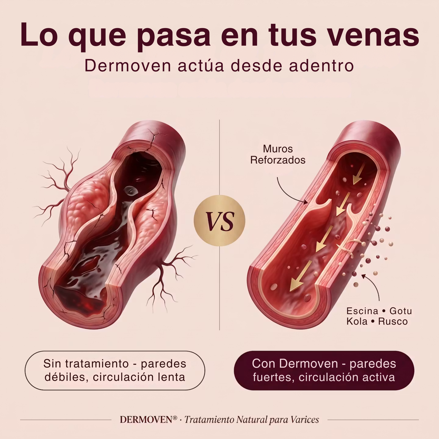 DERMOVEN® - Recuperá la circulación y el alivio en tus piernas