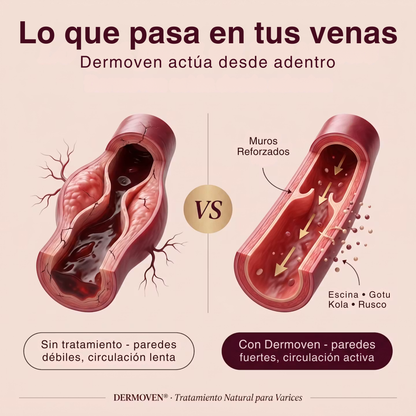 DERMOVEN® - Recuperá la circulación y el alivio en tus piernas