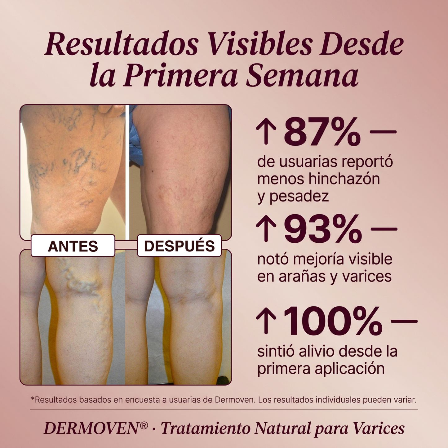 DERMOVEN® - Recuperá la circulación y el alivio en tus piernas