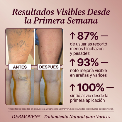 DERMOVEN® - Recuperá la circulación y el alivio en tus piernas